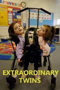 Extraordinary Twins