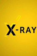 X-Ray