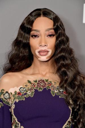 Winnie Harlow